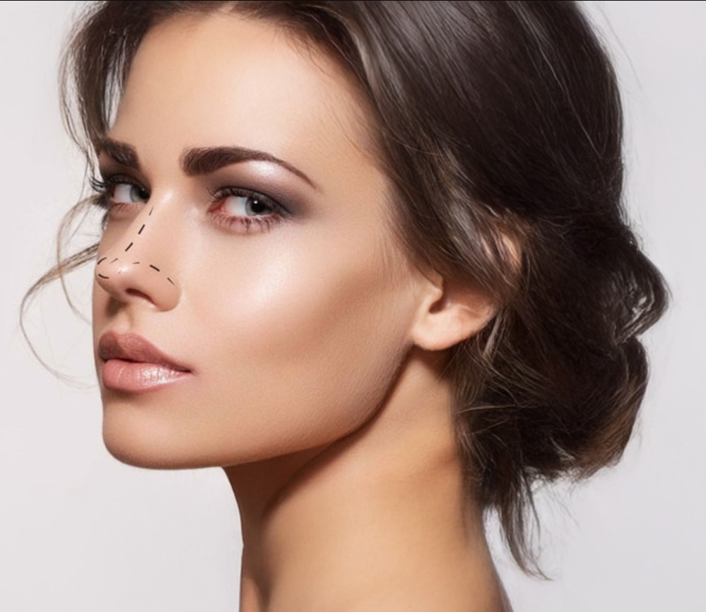 Kayseri estetik cerrah